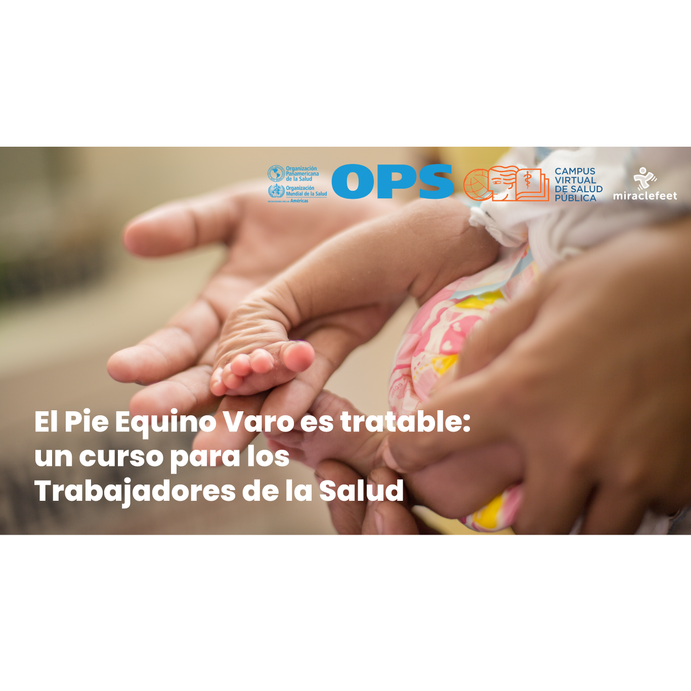 Manejo del Pie equino varo Orientación para fortalecer los servicios